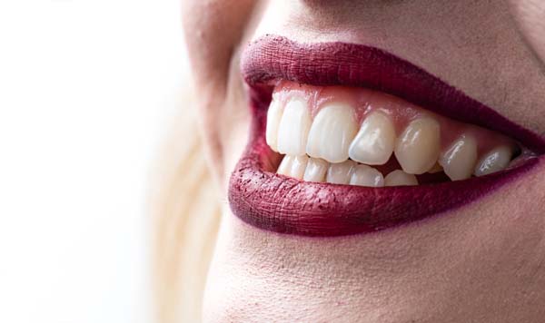 Cosmetic Dentistry With Dental Bonding
