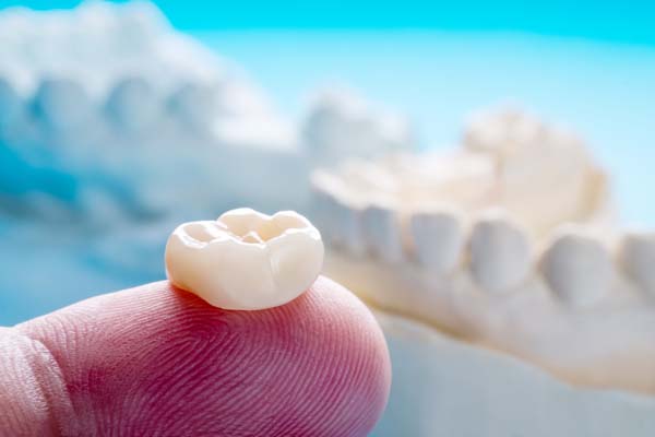 Can A Dental Crown Break?