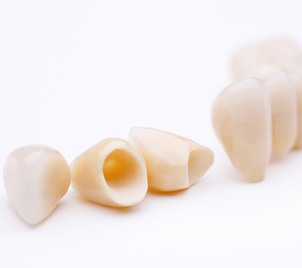 Bowie Dental Crowns and Dental Bridges