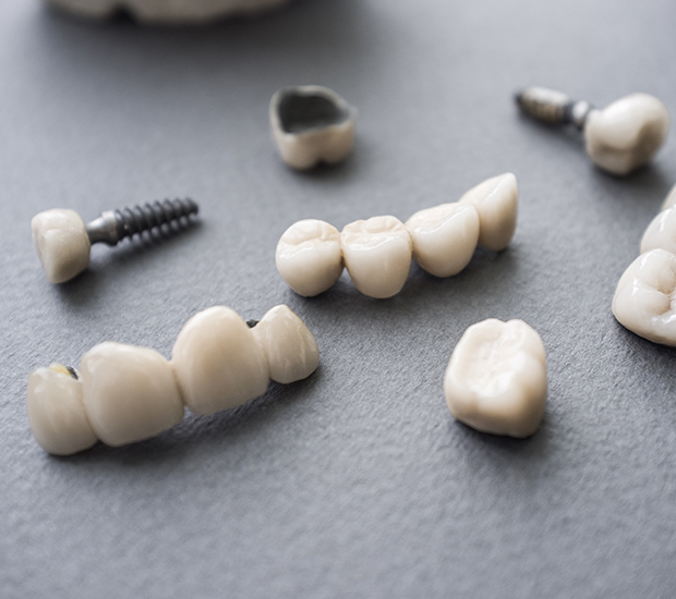 Bowie The Difference Between Dental Implants and Mini Dental Implants