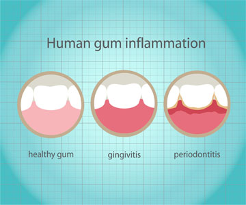 Periodontics