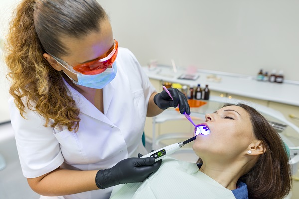 Maintenance Tips After Professional Teeth Whitening