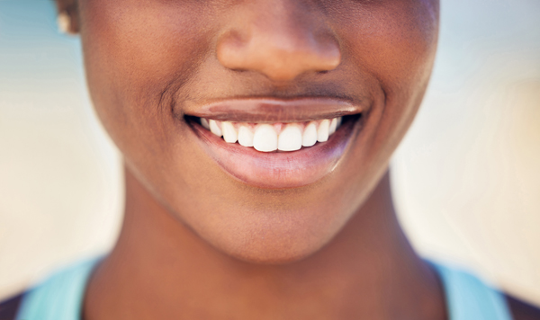 What You Need To Know About At Home Teeth Whitening From A Dentist