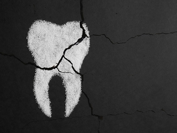 Tooth Decay Bowie, MD