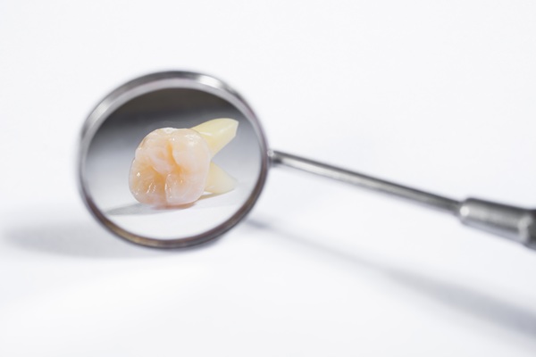 Dry Socket After Tooth Extraction: When To Seek Follow Up Care