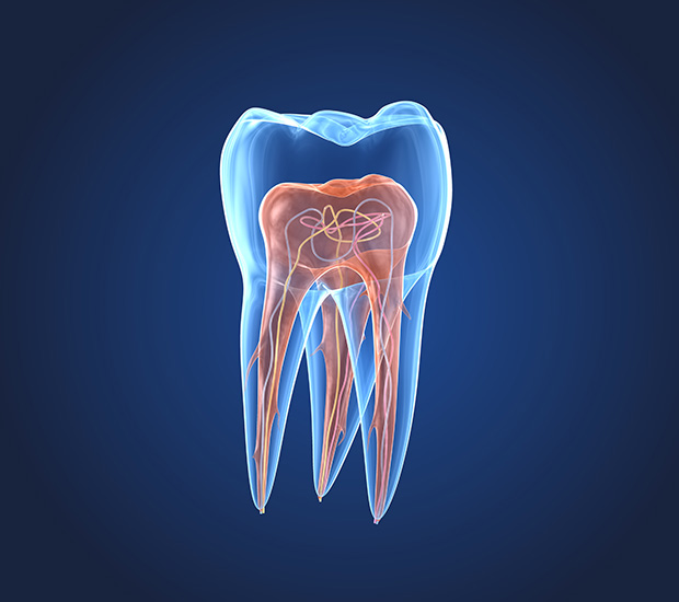 Bowie What is an Endodontist